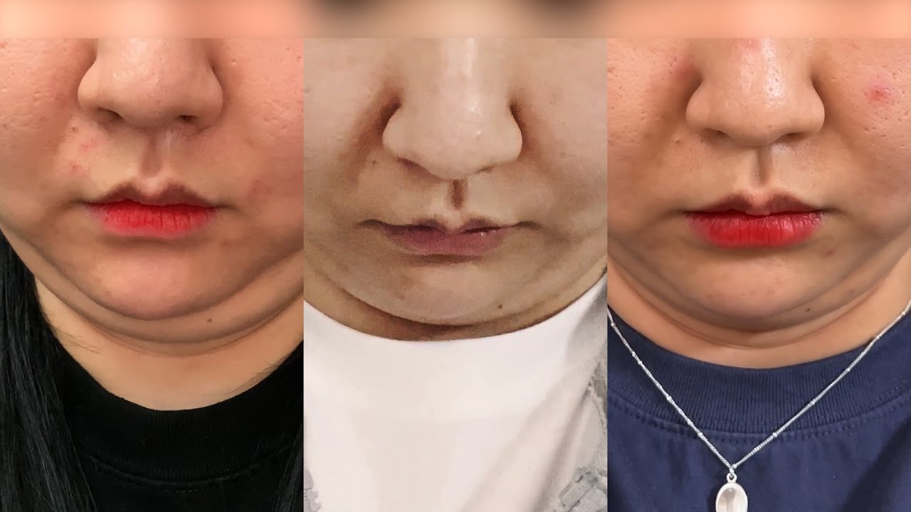 관련 이미지 3