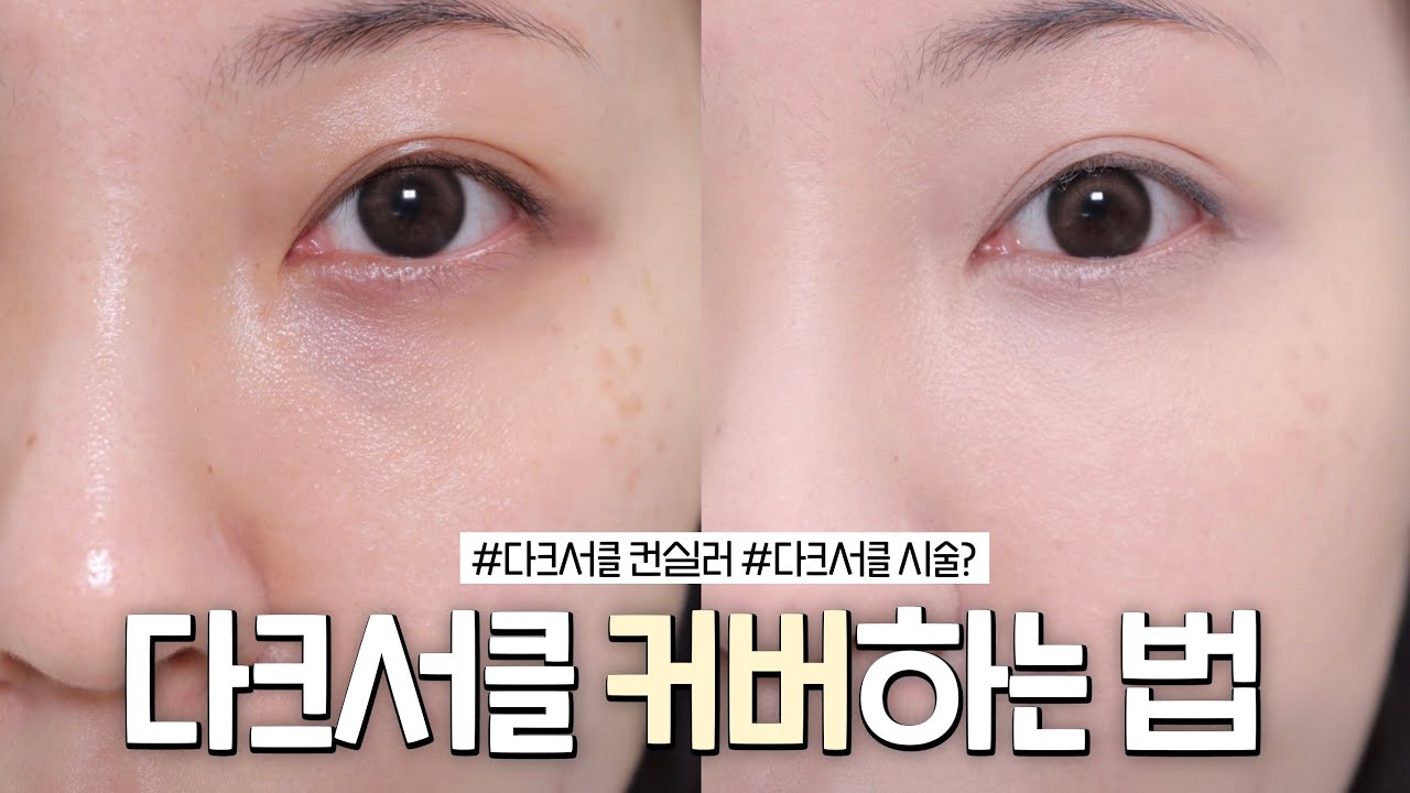 관련 이미지 2