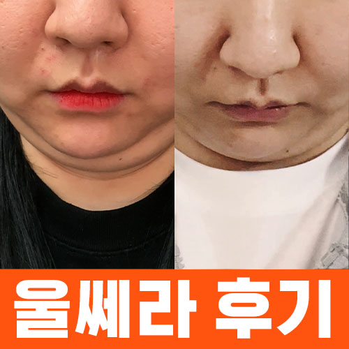 관련 이미지 1