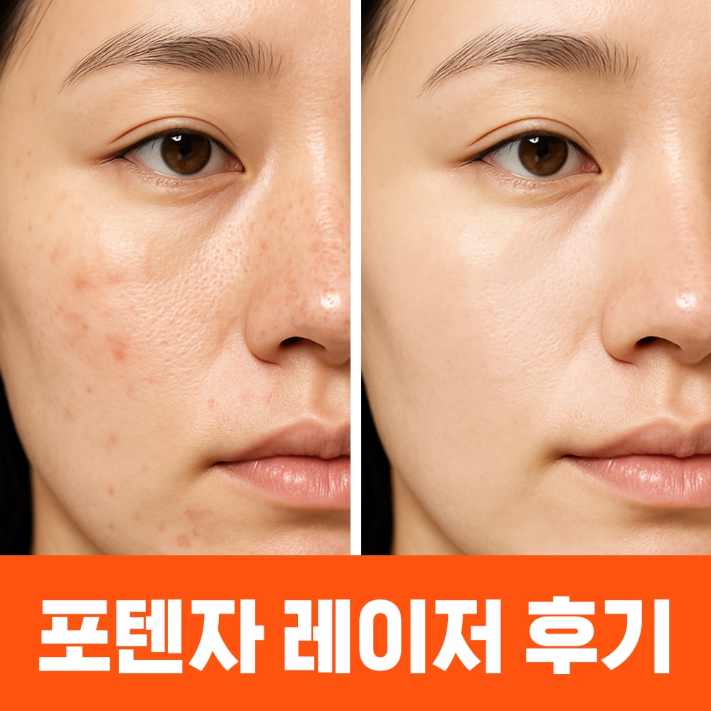 관련 이미지 3